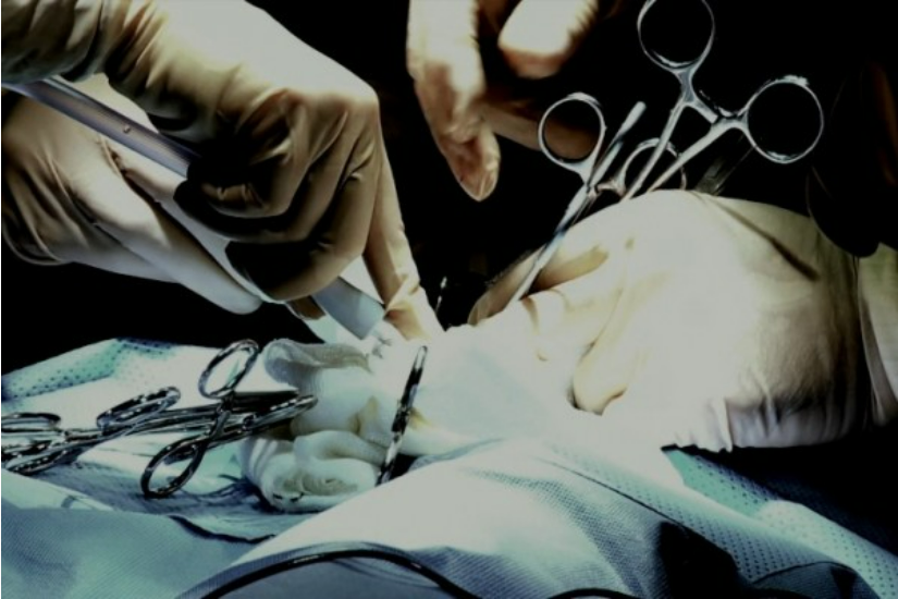 昆明医院一天31例移植 美政要质疑器官来源