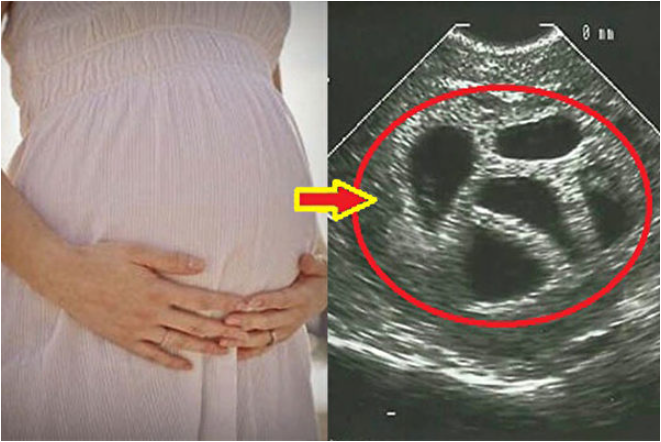 北京退休人员产检也可报销 引争议